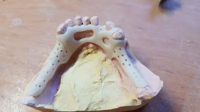 Protetyk Piła - Estetic Smile - Naprawa protez